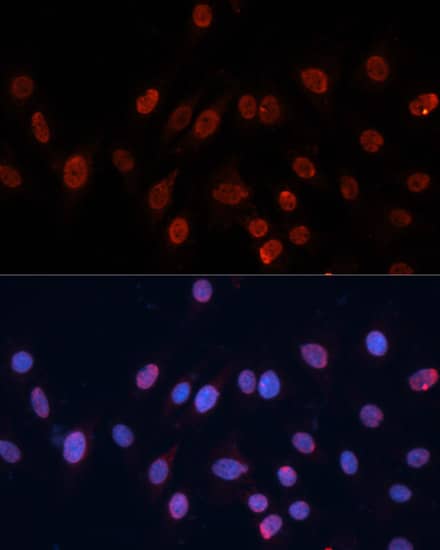 Immunocytochemistry/ Immunofluorescence: hnRNP U Antibody [NBP3-38059] - Immunofluorescence analysis of C6 cells using hnRNP U Rabbit pAb at dilution of 1:100. Secondary antibody: Cy3-conjugated Goat anti-Rabbit IgG (H+L) at 1:500 dilution. Blue: DAPI for nuclear staining.