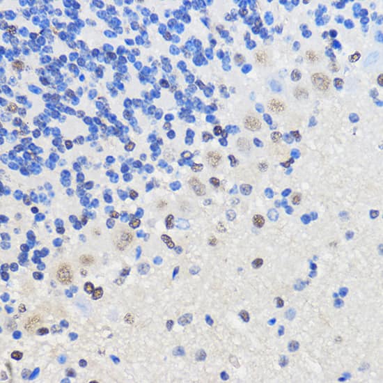 Immunohistochemistry: hnRNP U Antibody [NBP3-38059] - Immunohistochemistry analysis of paraffin-embedded Mouse brain using hnRNP U Rabbit pAb at dilution of 1:50 (40x lens). Microwave antigen retrieval performed with 0.01M PBS Buffer (pH 7.2) prior to IHC staining.