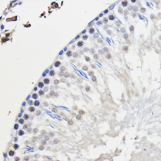 Immunohistochemistry: hnRNP U Antibody [NBP3-38059] - Immunohistochemistry analysis of paraffin-embedded Rat testis using hnRNP U Rabbit pAb at dilution of 1:50 (40x lens). Microwave antigen retrieval performed with 0.01M PBS Buffer (pH 7.2) prior to IHC staining.