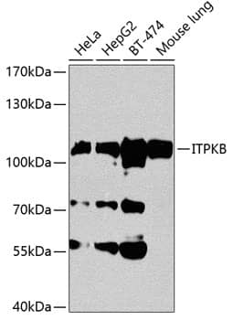 Western Blot: ITPKB Antibody [NBP3-38060] - Western blot analysis of various lysates using ITPKB Rabbit pAb at 1:1000 dilution.Secondary antibody: HRP-conjugated Goat anti-Rabbit IgG (H+L) at 1:10000 dilution.Lysates/proteins: 25ug per lane.Blocking buffer: 3% nonfat dry milk in TBST.Detection: ECL Basic Kit.Exposure time: 60s.