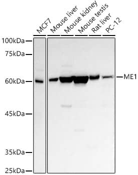 Western Blot: ME1 Antibody [NBP3-38062] - Western blot analysis of various lysates using ME1 Rabbit pAb at 1:500 dilution.Secondary antibody: HRP-conjugated Goat anti-Rabbit IgG (H+L) at 1:10000 dilution.Lysates/proteins: 25ug per lane.Blocking buffer: 3% nonfat dry milk in TBST.Detection: ECL Basic Kit.Exposure time: 30s.