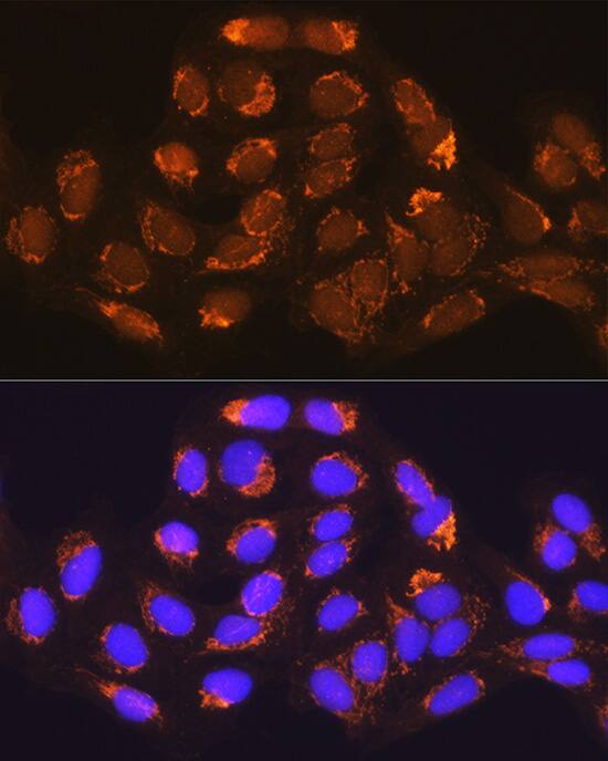 Immunocytochemistry/ Immunofluorescence: Methylmalonyl Coenzyme A mutase Antibody [NBP3-38063] - Immunofluorescence analysis of U-2 OS cells using Methylmalonyl Coenzyme A mutase Rabbit pAb at dilution of 1:100 (40x lens). Secondary antibody: Cy3-conjugated Goat anti-Rabbit IgG (H+L) at 1:500 dilution. Blue: DAPI for nuclear staining.