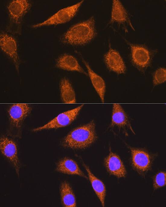 Immunocytochemistry/ Immunofluorescence: Methylmalonyl Coenzyme A mutase Antibody [NBP3-38063] - Immunofluorescence analysis of L929 cells using Methylmalonyl Coenzyme A mutase Rabbit pAb at dilution of 1:100 (40x lens). Secondary antibody: Cy3-conjugated Goat anti-Rabbit IgG (H+L) at 1:500 dilution. Blue: DAPI for nuclear staining.