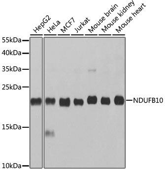Western Blot: NDUFB10 Antibody [NBP3-38064] - Western blot analysis of various lysates using NDUFB10 Rabbit pAb at 1:1000 dilution.Secondary antibody: HRP-conjugated Goat anti-Rabbit IgG (H+L) at 1:10000 dilution.Lysates/proteins: 25ug per lane.Blocking buffer: 3% nonfat dry milk in TBST.Detection: ECL Basic Kit.Exposure time: 10s.