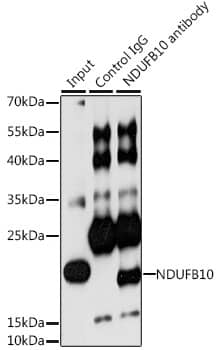 Immunoprecipitation: NDUFB10 Antibody [NBP3-38064] - Immunoprecipitation analysis of 200 ug extracts of HeLa cells, using 3 ug NDUFB10 antibody. Western blot was performed from the immunoprecipitate using NDUFB10 antibody at a dilution of 1:1000.