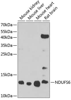 Western Blot: NDUFS6 Antibody [NBP3-38065] - Western blot analysis of various lysates using NDUFS6 Rabbit pAb at 1:1000 dilution.Secondary antibody: HRP-conjugated Goat anti-Rabbit IgG (H+L) at 1:10000 dilution.Lysates/proteins: 25ug per lane.Blocking buffer: 3% nonfat dry milk in TBST.Detection: ECL Basic Kit.Exposure time: 90s.