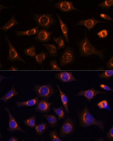 Immunocytochemistry/ Immunofluorescence: Nucleobindin 1 Antibody [NBP3-38066] - Immunofluorescence analysis of L929 cells using [KO Validated] Nucleobindin 1 Rabbit pAb at dilution of 1:100 (40x lens). Secondary antibody: Cy3-conjugated Goat anti-Rabbit IgG (H+L) at 1:500 dilution. Blue: DAPI for nuclear staining.