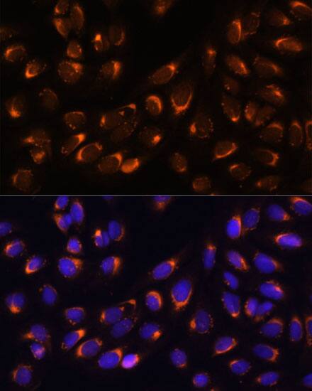 Immunocytochemistry/ Immunofluorescence: Nucleobindin 1 Antibody [NBP3-38066] - Immunofluorescence analysis of U-2 OS cells using [KO Validated] Nucleobindin 1 Rabbit pAb at dilution of 1:100 (40x lens). Secondary antibody: Cy3-conjugated Goat anti-Rabbit IgG (H+L) at 1:500 dilution. Blue: DAPI for nuclear staining.