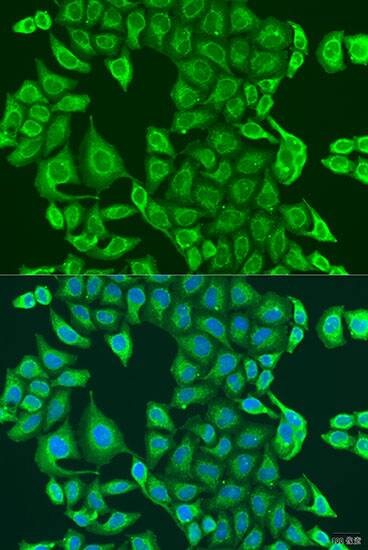 Immunocytochemistry/ Immunofluorescence: PDK2 Antibody [NBP3-38067] - Immunofluorescence analysis of U2OS cells using PDK2 Rabbit pAb at dilution of 1:100. Secondary antibody: Cy3-conjugated Goat anti-Rabbit IgG (H+L) at 1:500 dilution. Blue: DAPI for nuclear staining.