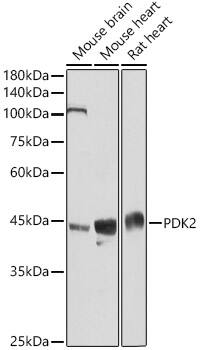Western Blot: PDK2 Antibody [NBP3-38067] - Western blot analysis of various lysates using PDK2 Rabbit pAb at 1:3000 dilution.Secondary antibody: HRP-conjugated Goat anti-Rabbit IgG (H+L) at 1:10000 dilution.Lysates/proteins: 25ug per lane.Blocking buffer: 3% nonfat dry milk in TBST.Detection: ECL Basic Kit.Exposure time: 10s.