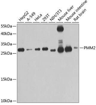 Western Blot: PMM2/Phosphomannomutase 2 Antibody [NBP3-38068] - Western blot analysis of various lysates using PMM2/Phosphomannomutase 2 Rabbit pAb at 1:1000 dilution.Secondary antibody: HRP-conjugated Goat anti-Rabbit IgG (H+L) at 1:10000 dilution.Lysates/proteins: 25ug per lane.Blocking buffer: 3% nonfat dry milk in TBST.Detection: ECL Basic Kit.Exposure time: 60s.