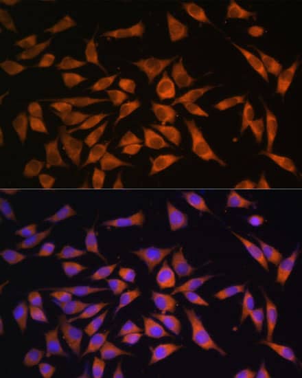 Immunocytochemistry/ Immunofluorescence: PMM2/Phosphomannomutase 2 Antibody [NBP3-38068] - Immunofluorescence analysis of L929 cells using PMM2/Phosphomannomutase 2 Rabbit pAb at dilution of 1:100. Secondary antibody: Cy3-conjugated Goat anti-Rabbit IgG (H+L) at 1:500 dilution. Blue: DAPI for nuclear staining.