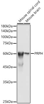 Western Blot: Peripherin Antibody [NBP3-38070] - Western blot analysis of various lysates using Peripherin Rabbit pAb at 1:500 dilution.Secondary antibody: HRP-conjugated Goat anti-Rabbit IgG (H+L) at 1:10000 dilution.Lysates/proteins: 25ug per lane.Blocking buffer: 3% nonfat dry milk in TBST.Detection: ECL Basic Kit.Exposure time: 1s.