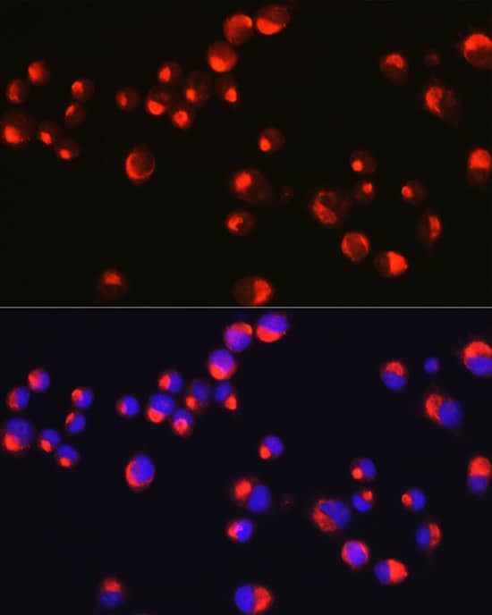 Immunocytochemistry/ Immunofluorescence: Peripherin Antibody [NBP3-38070] - Immunofluorescence analysis of Neuro-2a cells using Peripherin Rabbit pAb at dilution of 1:20 (40x lens). Secondary antibody: Cy3-conjugated Goat anti-Rabbit IgG (H+L) at 1:500 dilution. Blue: DAPI for nuclear staining.