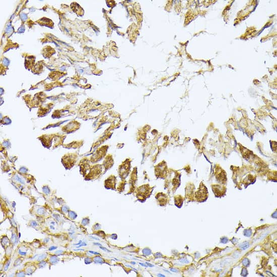 Immunohistochemistry: PSMA7 Antibody [NBP3-38071] - Immunohistochemistry analysis of paraffin-embedded Rat testis using PSMA7 Rabbit pAb at dilution of 1:100 (40x lens). Microwave antigen retrieval performed with 0.01M PBS Buffer (pH 7.2) prior to IHC staining.