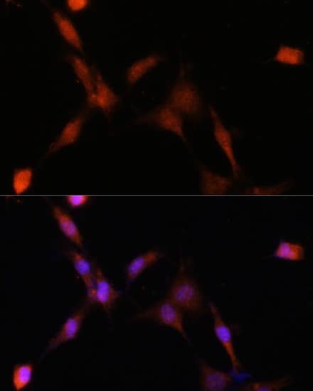 Immunocytochemistry/ Immunofluorescence: PSMA7 Antibody [NBP3-38071] - Immunofluorescence analysis of NIH-3T3 cells using PSMA7 Rabbit pAb at dilution of 1:100. Secondary antibody: Cy3-conjugated Goat anti-Rabbit IgG (H+L) at 1:500 dilution. Blue: DAPI for nuclear staining.