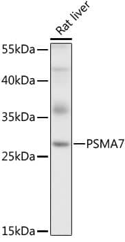 Western Blot: PSMA7 Antibody [NBP3-38071] - Western blot analysis of lysates from rat liver, using PSMA7 Rabbit pAb at 1:1000 dilution.Secondary antibody: HRP-conjugated Goat anti-Rabbit IgG (H+L) at 1:10000 dilution.Lysates/proteins: 25ug per lane.Blocking buffer: 3% nonfat dry milk in TBST.Detection: ECL Basic Kit.Exposure time: 5s.