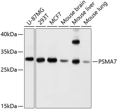 Western Blot: PSMA7 Antibody [NBP3-38071] - Western blot analysis of various lysates using PSMA7 Rabbit pAb at 1:1000 dilution.Secondary antibody: HRP-conjugated Goat anti-Rabbit IgG (H+L) at 1:10000 dilution.Lysates/proteins: 25ug per lane.Blocking buffer: 3% nonfat dry milk in TBST.Detection: ECL Basic Kit.Exposure time: 1s.