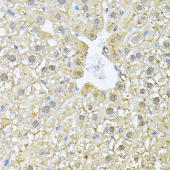 Immunohistochemistry: PSMA7 Antibody [NBP3-38071] - Immunohistochemistry analysis of paraffin-embedded Mouse liver using PSMA7 Rabbit pAb at dilution of 1:100 (40x lens). Microwave antigen retrieval performed with 0.01M PBS Buffer (pH 7.2) prior to IHC staining.