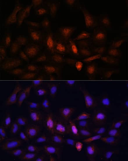 Immunocytochemistry/ Immunofluorescence: PSMA7 Antibody [NBP3-38071] - Immunofluorescence analysis of U-2 OS cells using PSMA7 Rabbit pAb at dilution of 1:100. Secondary antibody: Cy3-conjugated Goat anti-Rabbit IgG (H+L) at 1:500 dilution. Blue: DAPI for nuclear staining.