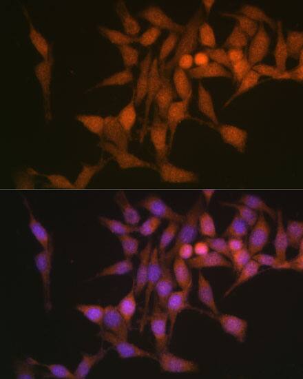 Immunocytochemistry/ Immunofluorescence: Proteasome 20S beta 6 Antibody [NBP3-38072] - Immunofluorescence analysis of HeLa cells using Proteasome 20S beta 6 Rabbit pAb at dilution of 1:100 (40x lens). Secondary antibody: Cy3-conjugated Goat anti-Rabbit IgG (H+L) at 1:500 dilution. Blue: DAPI for nuclear staining.