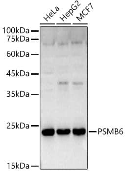 Western Blot: Proteasome 20S beta 6 Antibody [NBP3-38072] - Western blot analysis of various lysates, using Proteasome 20S beta 6 Rabbit pAb at  1:1000 dilution.Secondary antibody: HRP-conjugated Goat anti-Rabbit IgG (H+L) at 1:10000 dilution.Lysates/proteins: 25ug per lane.Blocking buffer: 3% nonfat dry milk in TBST.Detection: ECL Basic Kit.Exposure time: 10s.