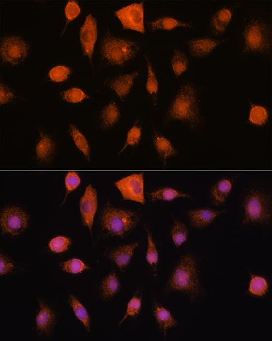 Immunocytochemistry/ Immunofluorescence: Ribonuclease Inhibitor Antibody [NBP3-38074] - Immunofluorescence analysis of L929 cells using Ribonuclease Inhibitor Rabbit pAb at dilution of 100 (40x lens). Secondary antibody: Cy3-conjugated Goat anti-Rabbit IgG (H+L) at 1:500 dilution. Blue: DAPI for nuclear staining.