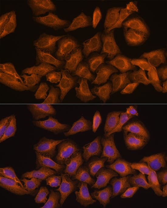 Immunocytochemistry/ Immunofluorescence: Ribonuclease Inhibitor Antibody [NBP3-38074] - Immunofluorescence analysis of U-2 OS cells using Ribonuclease Inhibitor Rabbit pAb at dilution of 100 (40x lens). Secondary antibody: Cy3-conjugated Goat anti-Rabbit IgG (H+L) at 1:500 dilution. Blue: DAPI for nuclear staining.