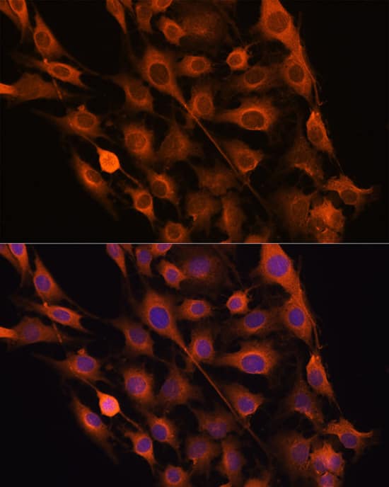 Immunocytochemistry/ Immunofluorescence: Ribonuclease Inhibitor Antibody [NBP3-38074] - Immunofluorescence analysis of C6 cells using Ribonuclease Inhibitor Rabbit pAb at dilution of 100 (40x lens). Secondary antibody: Cy3-conjugated Goat anti-Rabbit IgG (H+L) at 1:500 dilution. Blue: DAPI for nuclear staining.