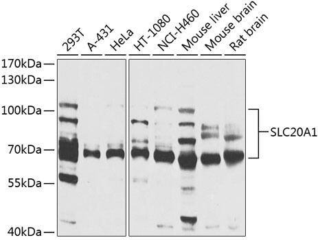 Western Blot: SLC20A1 Antibody [NBP3-38075] - Western blot analysis of various lysates using SLC20A1 Rabbit pAb at 1:1000 dilution.Secondary antibody: HRP-conjugated Goat anti-Rabbit IgG (H+L) at 1:10000 dilution.Lysates/proteins: 25ug per lane.Blocking buffer: 3% nonfat dry milk in TBST.Detection: ECL Basic Kit.Exposure time: 15s.