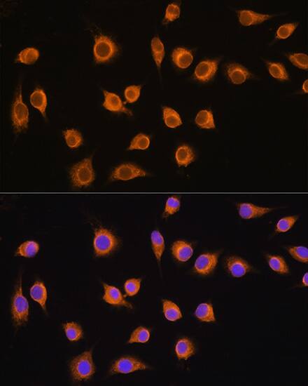 Immunocytochemistry/ Immunofluorescence: SLC20A1 Antibody [NBP3-38075] - Immunofluorescence analysis of L929 cells using SLC20A1 Rabbit pAb at dilution of 1:100. Blue: DAPI for nuclear staining.