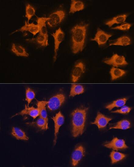 Immunocytochemistry/ Immunofluorescence: SLC20A1 Antibody [NBP3-38075] - Immunofluorescence analysis of C6 cells using SLC20A1 Rabbit pAb at dilution of 1:100. Blue: DAPI for nuclear staining.