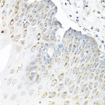 Immunohistochemistry: Staufen Antibody [NBP3-38076] - Immunohistochemistry analysis of paraffin-embedded Human esophagus using Staufen Rabbit pAb at dilution of 1:100 (40x lens). Microwave antigen retrieval performed with 0.01M PBS Buffer (pH 7.2) prior to IHC staining.