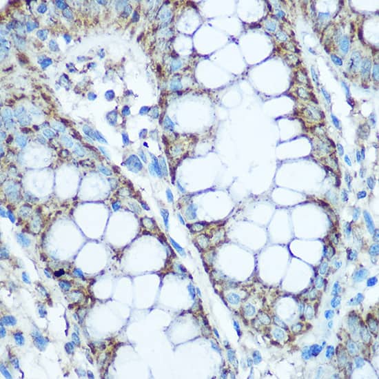 Immunohistochemistry: UQCRC2 Antibody [NBP3-38078] - Immunohistochemistry analysis of paraffin-embedded Human colon using UQCRC2 Rabbit pAb at dilution of 1:100 (40x lens). Microwave antigen retrieval performed with 0.01M Tris/EDTA Buffer (pH 9.0) prior to IHC staining.