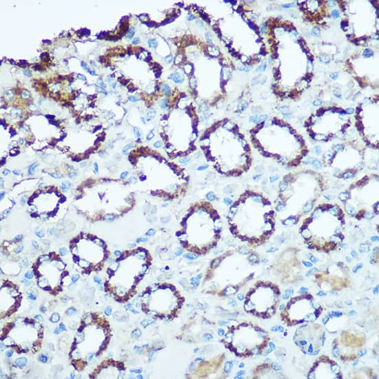 Immunohistochemistry: UQCRC2 Antibody [NBP3-38078] - Immunohistochemistry analysis of paraffin-embedded Rat kidney using UQCRC2 Rabbit pAb at dilution of 1:100 (40x lens). Microwave antigen retrieval performed with 0.01M Tris/EDTA Buffer (pH 9.0) prior to IHC staining.