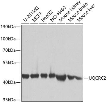 Western Blot: UQCRC2 Antibody [NBP3-38078] - Western blot analysis of various lysates using UQCRC2 Rabbit pAb at 1:1000 dilution.Secondary antibody: HRP-conjugated Goat anti-Rabbit IgG (H+L) at 1:10000 dilution.Lysates/proteins: 25ug per lane.Blocking buffer: 3% nonfat dry milk in TBST.Detection: ECL Basic Kit.Exposure time: 1s.