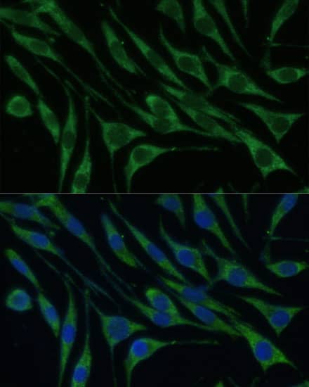 Immunocytochemistry/ Immunofluorescence: VARS Antibody [NBP3-38079] - Immunofluorescence analysis of L929 cells using VARS Rabbit pAb at dilution of 1:100 (40x lens). Secondary antibody: Cy3-conjugated Goat anti-Rabbit IgG (H+L) at 1:500 dilution. Blue: DAPI for nuclear staining.