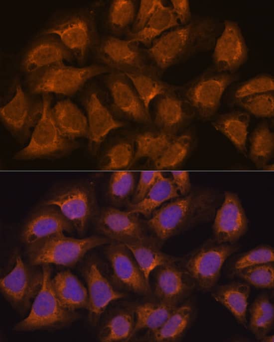 Immunocytochemistry/ Immunofluorescence: Isopeptidase T/USP5 Antibody [NBP3-38080] - Immunofluorescence analysis of U2OS cells using Isopeptidase T/USP5 Rabbit pAb at dilution of 1:100. Secondary antibody: Cy3-conjugated Goat anti-Rabbit IgG (H+L) at 1:500 dilution. Blue: DAPI for nuclear staining.