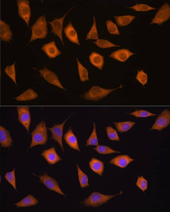 Immunocytochemistry/ Immunofluorescence: Isopeptidase T/USP5 Antibody [NBP3-38080] - Immunofluorescence analysis of L929 cells using Isopeptidase T/USP5 Rabbit pAb at dilution of 1:100. Secondary antibody: Cy3-conjugated Goat anti-Rabbit IgG (H+L) at 1:500 dilution. Blue: DAPI for nuclear staining.