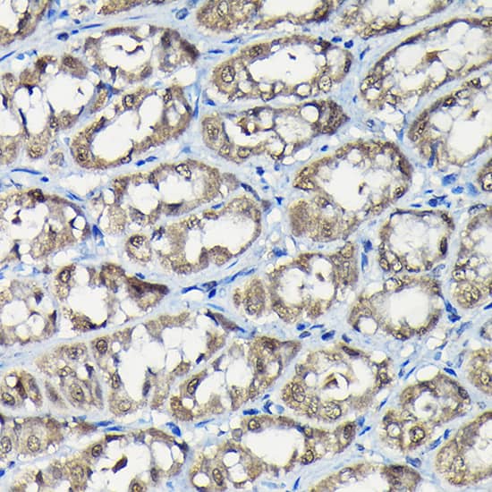Immunohistochemistry: Isopeptidase T/USP5 Antibody [NBP3-38080] - Immunohistochemistry analysis of paraffin-embedded Rat stomach using Isopeptidase T/USP5 Rabbit pAb at dilution of 1:100 (40x lens). High pressure antigen retrieval performed with 0.01M Citrate Bufferr (pH 6.0) prior to IHC staining.
