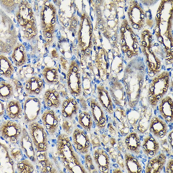 Immunohistochemistry: Isopeptidase T/USP5 Antibody [NBP3-38080] - Immunohistochemistry analysis of paraffin-embedded Mouse kidney using Isopeptidase T/USP5 Rabbit pAb at dilution of 1:100 (40x lens). High pressure antigen retrieval performed with 0.01M Citrate Bufferr (pH 6.0) prior to IHC staining.