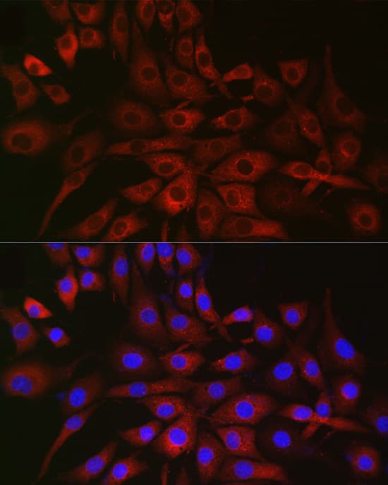 Immunocytochemistry/ Immunofluorescence: P4HA2 Antibody [NBP3-38083] - Immunofluorescence analysis of NIH/3T3 cells using P4HA2 Rabbit pAb at dilution of 1:50 (40x lens). Secondary antibody: Cy3-conjugated Goat anti-Rabbit IgG (H+L) at 1:500 dilution. Blue: DAPI for nuclear staining.