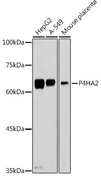 Western Blot: P4HA2 Antibody [NBP3-38083] - Western blot analysis of various lysates using P4HA2 Rabbit pAb at 1:500 dilution.Secondary antibody: HRP-conjugated Goat anti-Rabbit IgG (H+L) at 1:10000 dilution.Lysates/proteins: 25ug per lane.Blocking buffer: 3% nonfat dry milk in TBST.Detection: ECL Basic Kit.Exposure time: 1s.