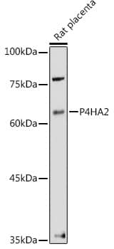 Western Blot: P4HA2 Antibody [NBP3-38083] - Western blot analysis of lysates from Rat placenta, using P4HA2 Rabbit pAb at 1:500 dilution.Secondary antibody: HRP-conjugated Goat anti-Rabbit IgG (H+L) at 1:10000 dilution.Lysates/proteins: 25ug per lane.Blocking buffer: 3% nonfat dry milk in TBST.Detection: ECL Enhanced Kit.Exposure time: 180s.