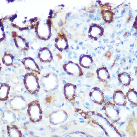 Immunohistochemistry LONP1 Antibody