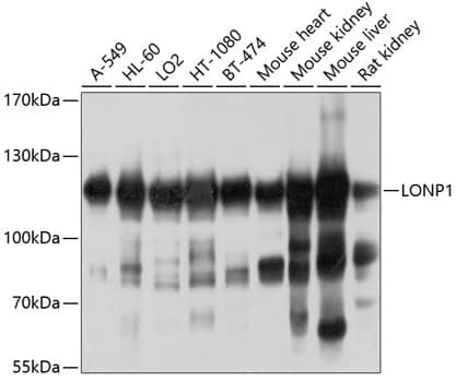 Western Blot: LONP1 Antibody [NBP3-38085] - Western blot analysis of various lysates using LONP1 Rabbit pAb at 1:1000 dilution.Secondary antibody: HRP-conjugated Goat anti-Rabbit IgG (H+L) at 1:10000 dilution.Lysates/proteins: 25ug per lane.Blocking buffer: 3% nonfat dry milk in TBST.Detection: ECL Basic Kit.Exposure time: 5s.