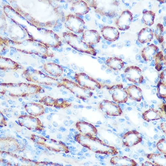 Immunohistochemistry: LONP1 Antibody [NBP3-38085] - Immunohistochemistry analysis of paraffin-embedded Mouse kidney using LONP1 Rabbit pAb at dilution of 1:100 (40x lens). Microwave antigen retrieval performed with 0.01M Tris/EDTA Buffer (pH 9.0) prior to IHC staining.