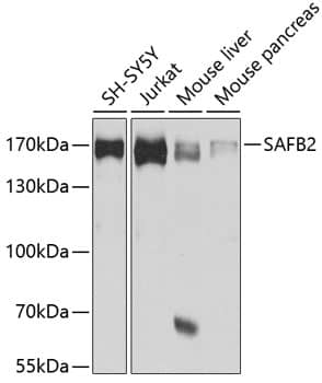 Western Blot: Scaffold attachment factor B2 Antibody [NBP3-38086] - Western blot analysis of various lysates using Scaffold attachment factor B2 Rabbit pAb at 1:1000 dilution.Secondary antibody: HRP-conjugated Goat anti-Rabbit IgG (H+L) at 1:10000 dilution.Lysates/proteins: 25ug per lane.Blocking buffer: 3% nonfat dry milk in TBST.Detection: ECL Basic Kit.Exposure time: 30s.