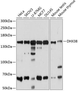 Western Blot: DHX38 Antibody [NBP3-38087] - Western blot analysis of various lysates using DHX38 Rabbit pAb at 1:1000 dilution.Secondary antibody: HRP-conjugated Goat anti-Rabbit IgG (H+L) at 1:10000 dilution.Lysates/proteins: 25ug per lane.Blocking buffer: 3% nonfat dry milk in TBST.Detection: ECL Basic Kit.Exposure time: 20s.