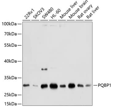 Western Blot: PQBP1 Antibody [NBP3-38089] - Western blot analysis of various lysates using PQBP1 Rabbit pAb at 1:1000 dilution.Secondary antibody: HRP-conjugated Goat anti-Rabbit IgG (H+L) at 1:10000 dilution.Lysates/proteins: 25ug per lane.Blocking buffer: 3% nonfat dry milk in TBST.Detection: ECL Basic Kit.Exposure time: 10s.